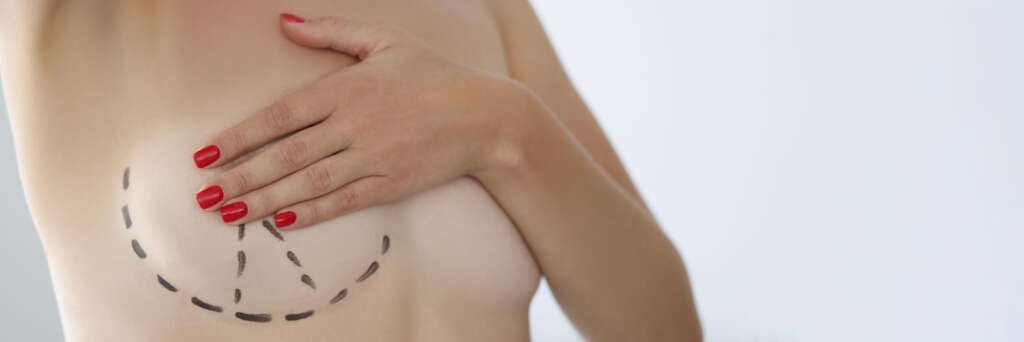 Augmentation vs Lift Article