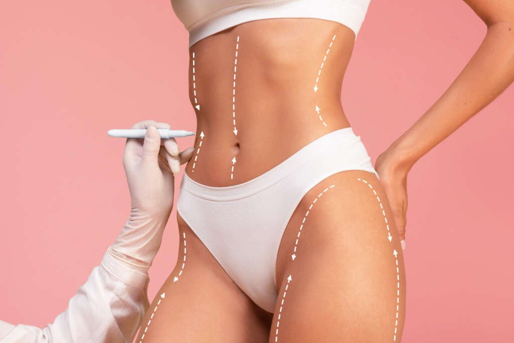 Body contouring and plastic surgery by Dr. Salim Ayoub in Lebanon