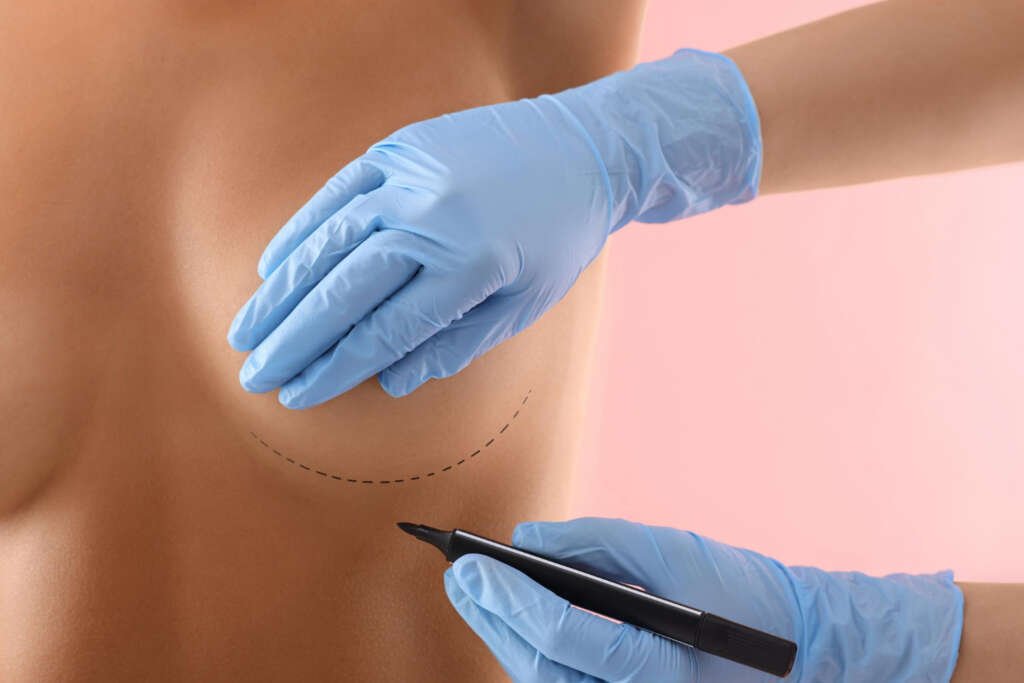 Breast surgery procedures by Dr. Salim Ayoub in Lebanon