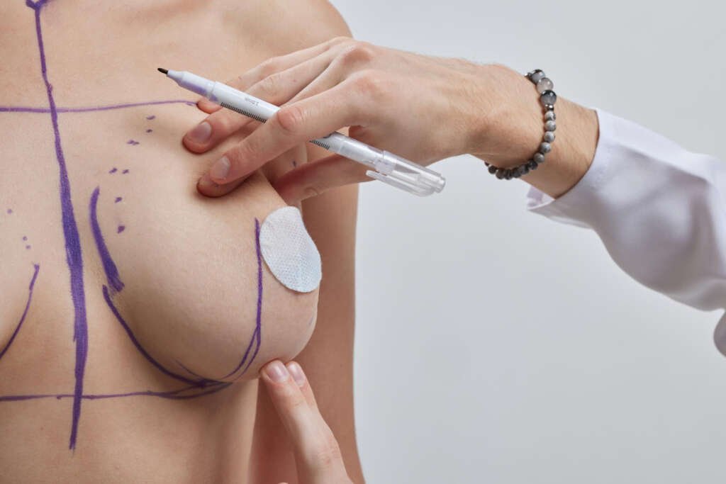 Breast Surgery (2)