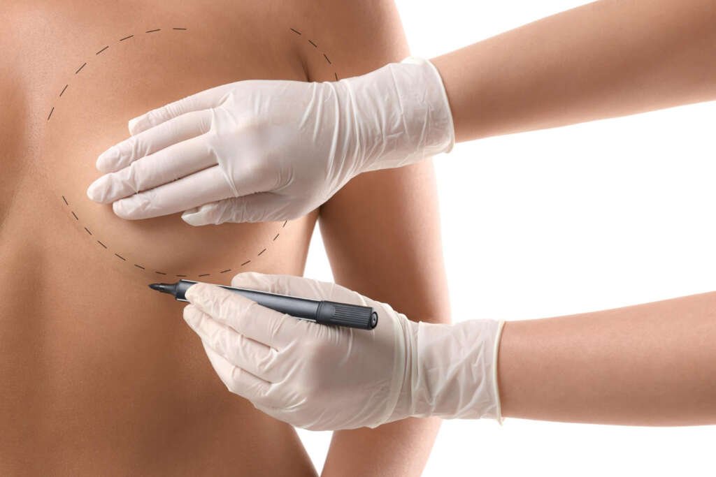 Breast Surgery 3